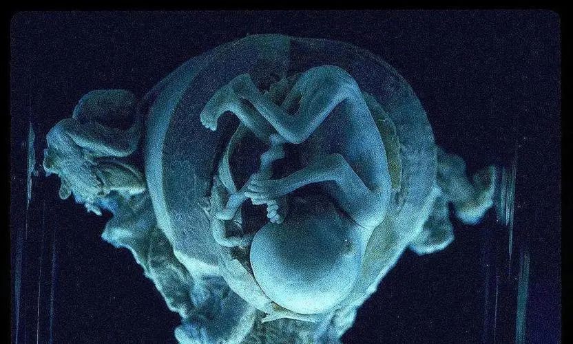 胎儿.jpg
